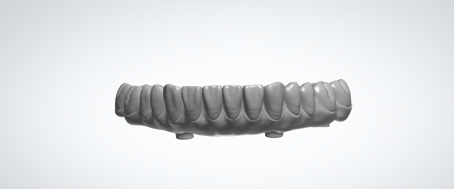 Digital dental design model